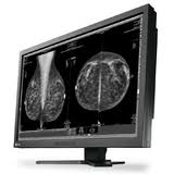 Eizo RadiForce GX1030