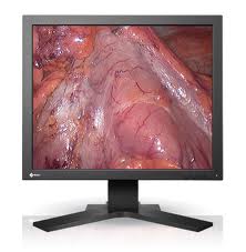 Eizo RadiForce SCD 19102